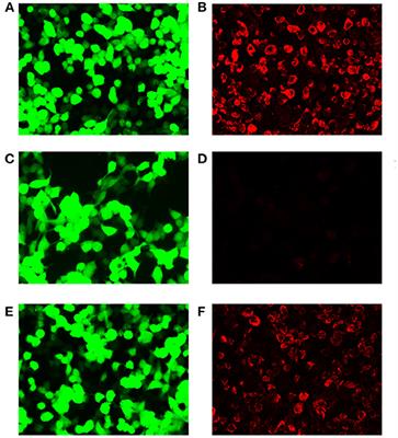 Case Report: Need for Caution in the Diagnosis of GFAP Astrocytopathy—A Case of GFAP Astrocytopathy Coexistent With Primary Central Nervous System Lymphoma